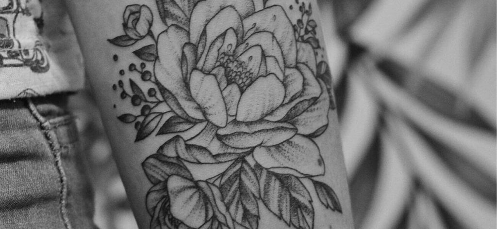 Borttagning av tatuering